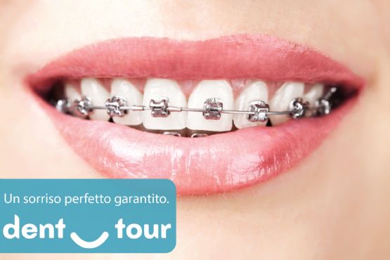 Orthodontsi / tela per dhembet cmimi / tela dhembesh transparente / drejtim dhembesh / drejtim dhembesh pa tela afrimi i dhembeve / drejtimi i dhembeve pa tela / drejtimi i dhembeve 3d / keshilla per dhembet / pyetje per dhembet